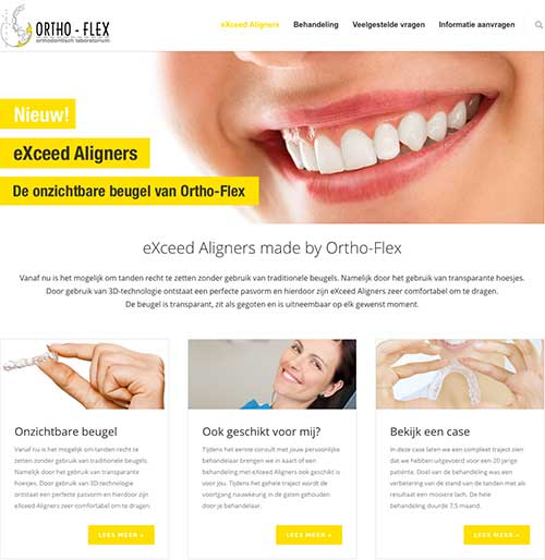 Website eXceed Aligners online